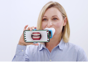 Smartphone-based Invisalign remote monitoring