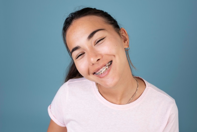 Braces for Teens